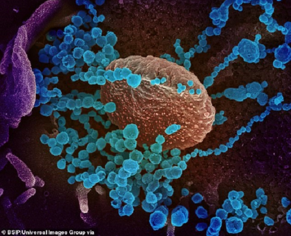 Hình ảnh trên kính hiển vi của một tế bào virus SARS-CoV-2. Ảnh: BSIP